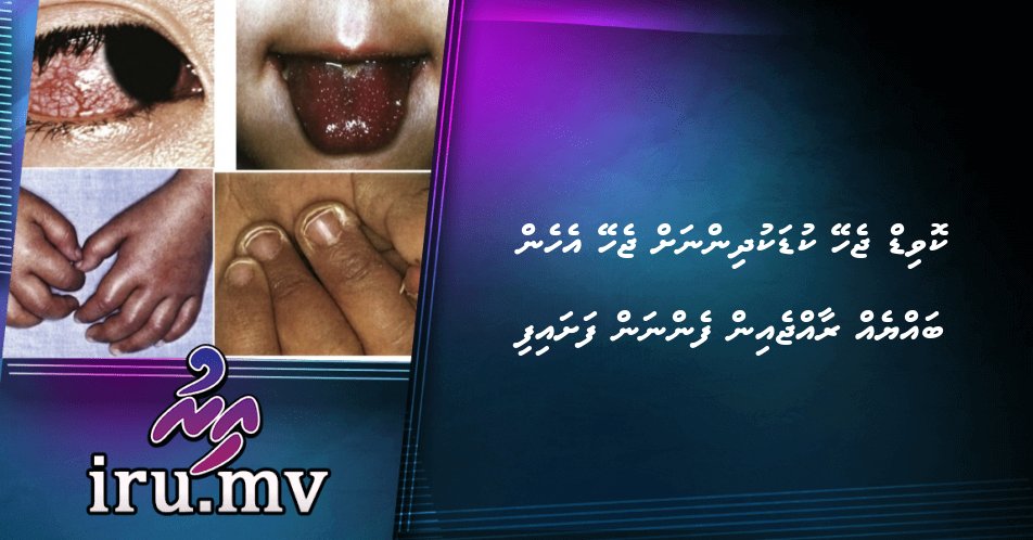 COVID jehey kudakudhinnah jehey ehen bahyeh raahjein fennan fashaifi – Iru